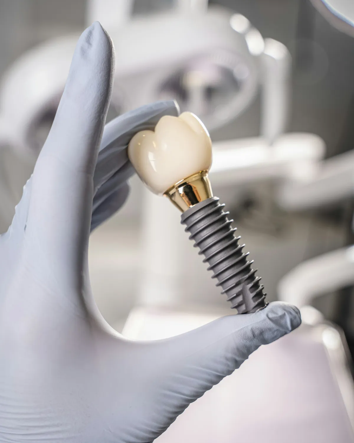 Implants dentaires